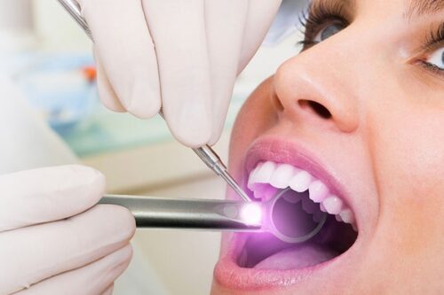 Photo of Oral Cancer Screenings