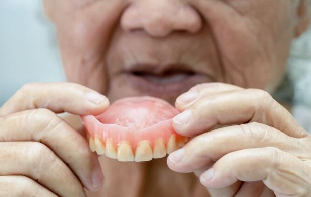 Snap-on-Dentures_